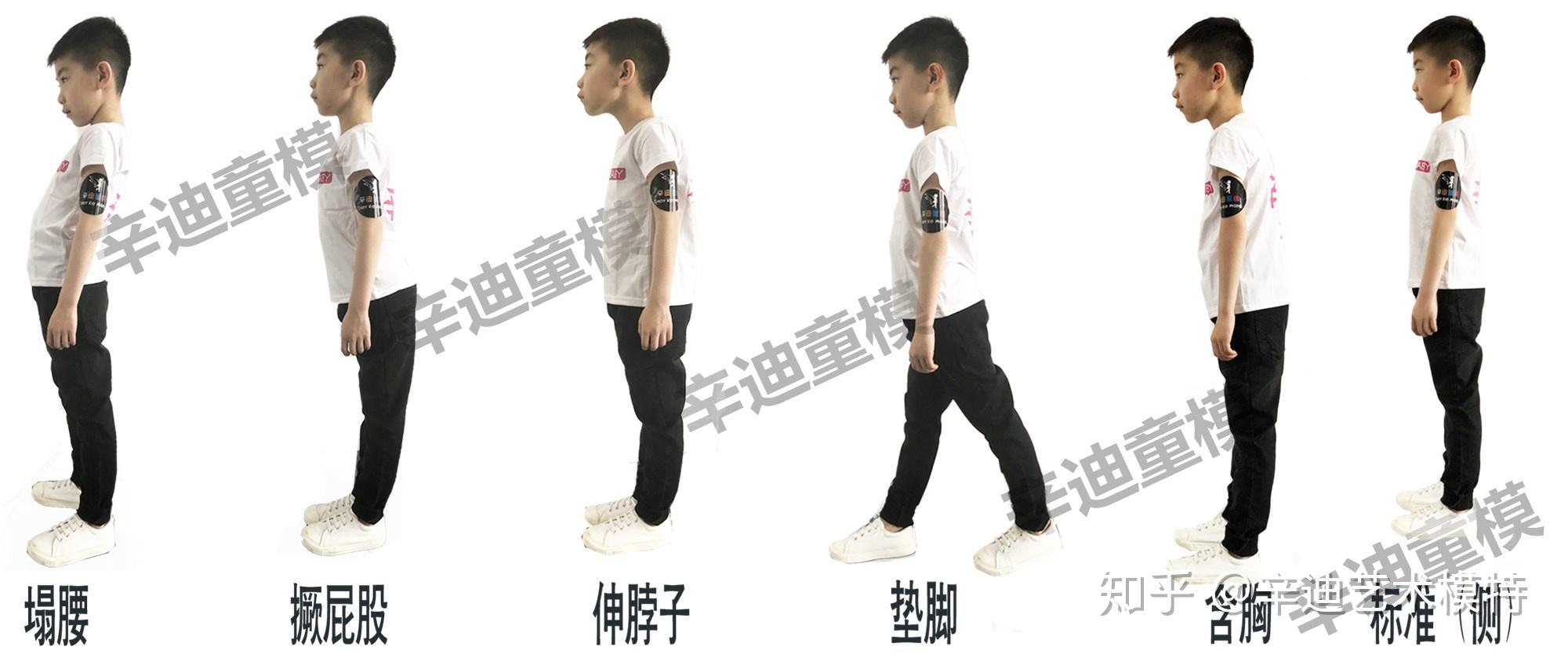 2,侧面观观察孩子是否有歪脖,倾头,端肩,高低肩,骨盆前倾,o型腿,x型腿