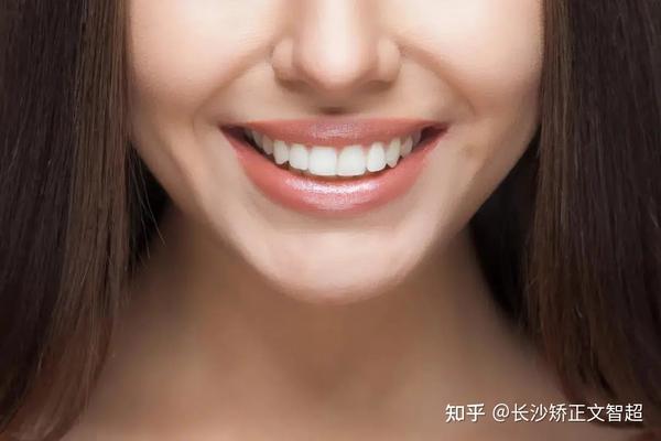 (用食指将面部中线与牙齿中线相对比,中线一致说明牙齿整齐)