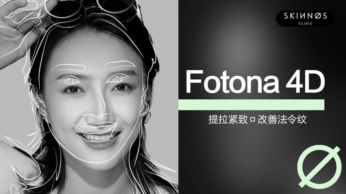 硬科普欧洲之星fotona4dpro最新解答