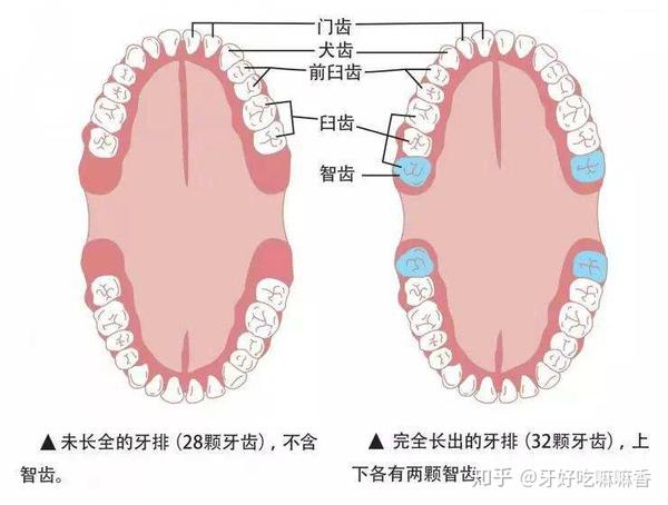 我们的牙齿多少颗才算是正常的?28颗还是32颗?