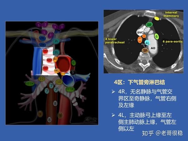 纵隔淋巴结分区与引流途径