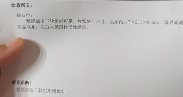 今天去医院检查了一下骶尾部分,做了个彩超,自我判断感觉像是藏毛窦