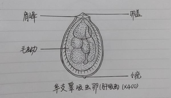 华支睾吸虫卵(肝吸虫) ,是吸虫虫卵中最小的虫卵