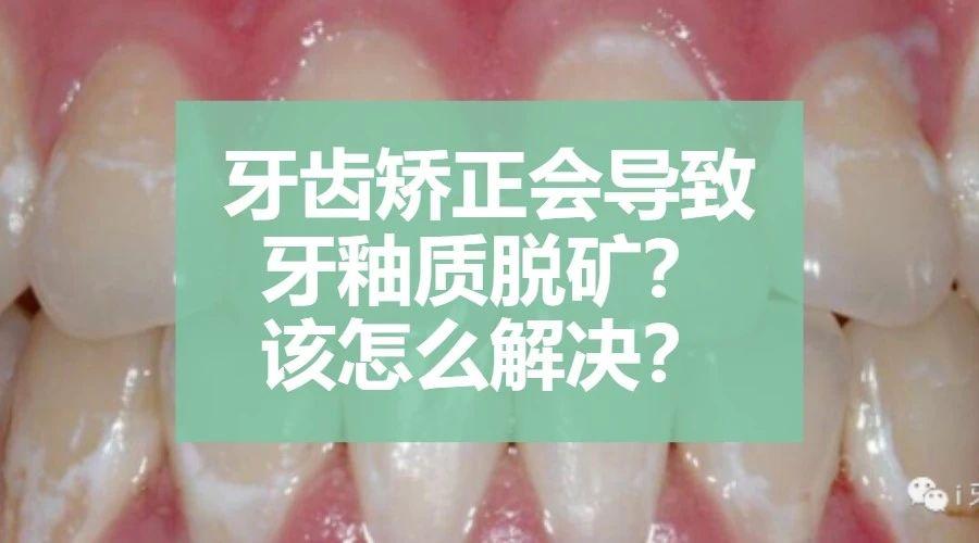 牙齿矫正会导致牙釉质脱矿?该怎么解决?