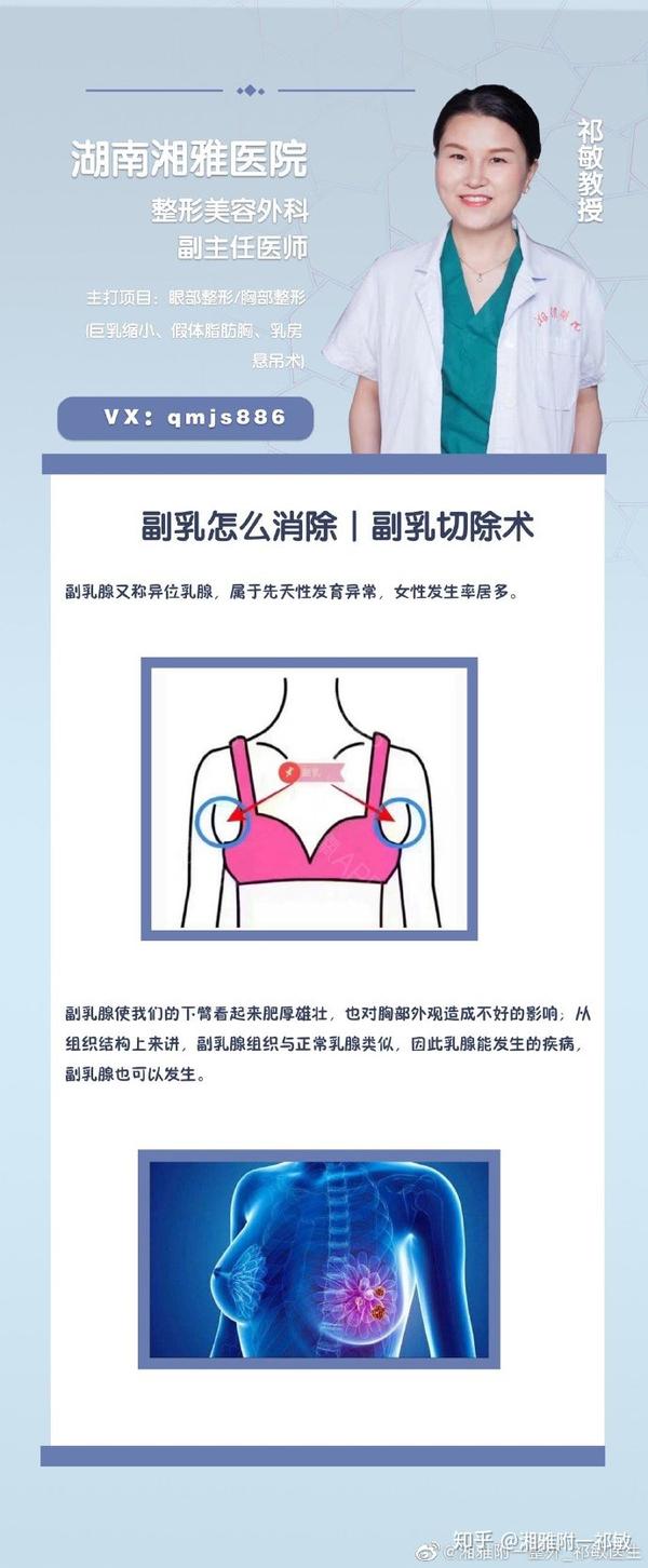 副乳怎么消除-副乳切除术