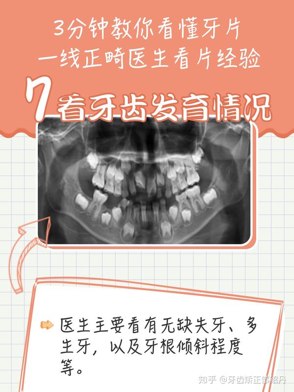 大致位置,大致判断是否有颞下颌关节紊乱问题 其实不用知道骨岛是什么