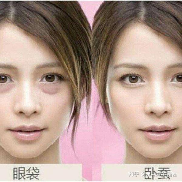 你以为是眼袋,就这么入了坑!眼部衰老你找对元凶了吗?