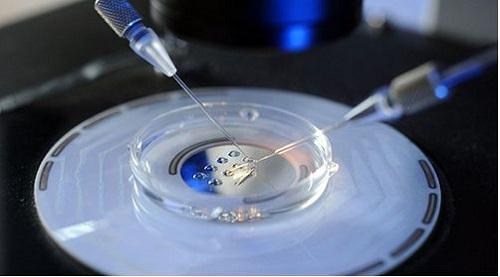 试管婴儿有几种胚胎移植方式?
