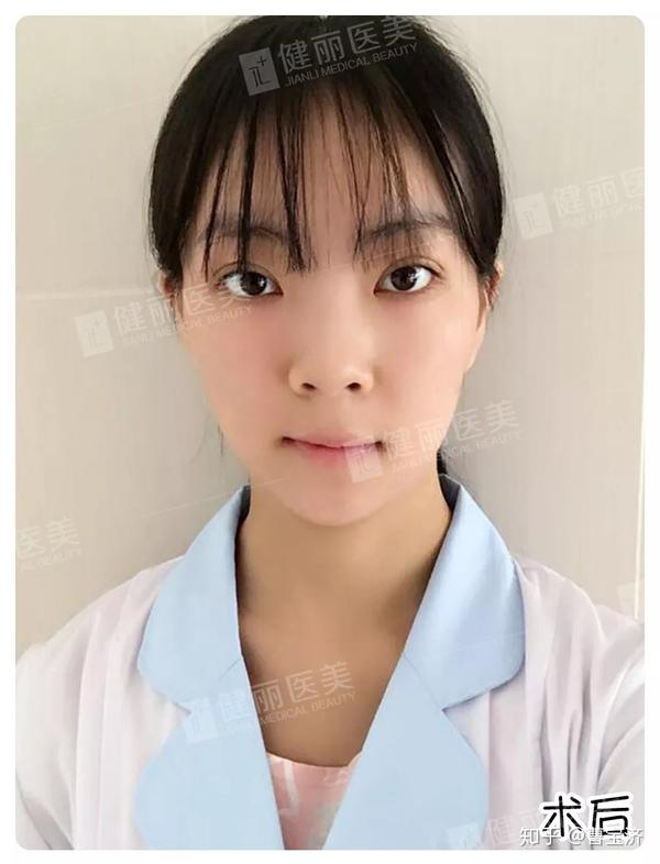 水汪汪的大眼睛自然又减龄.