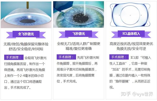 图2:近视手术方式及原理