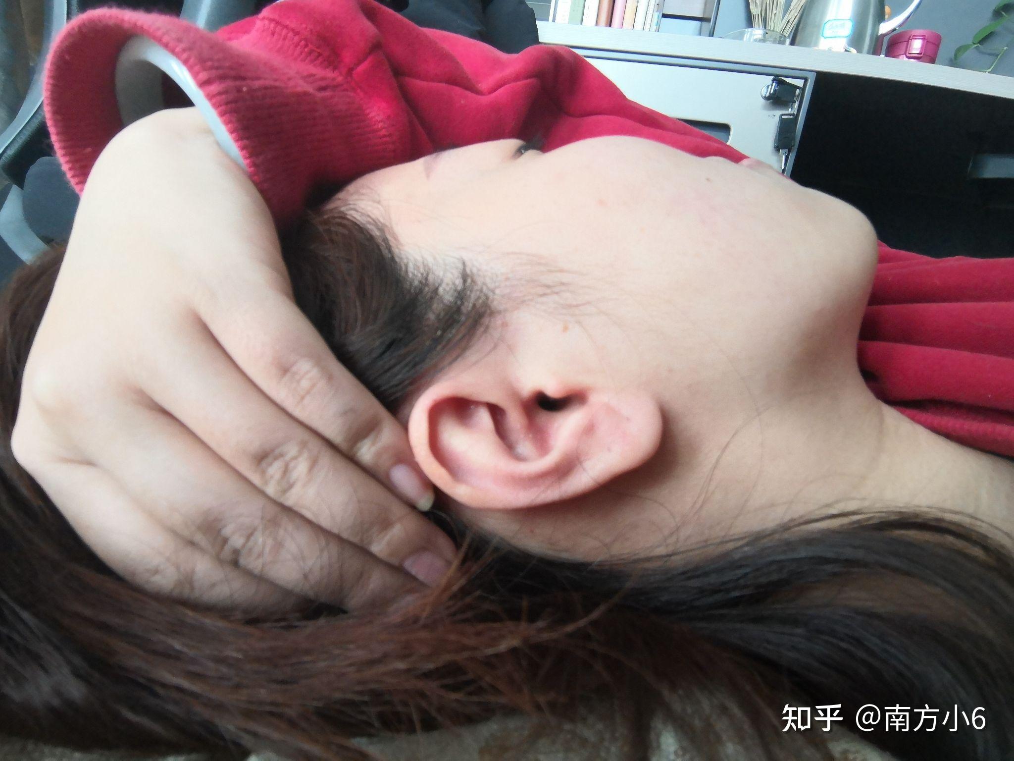 耳垂有折痕意味着什么