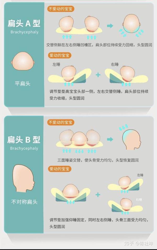 我现在就得坚持每天给宝宝按摩颈部肌肉,引导他往另外一侧转动,防止