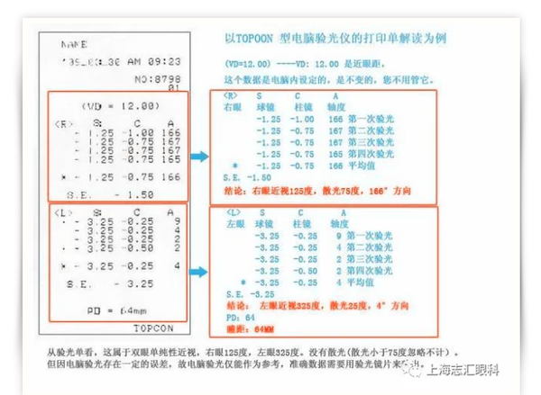 图丨电脑验光单解读