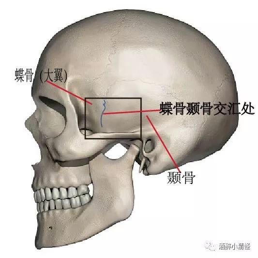 同时, 蝶骨与颞骨的交汇处,其实也是我们视觉判断太阳穴最低点的位置