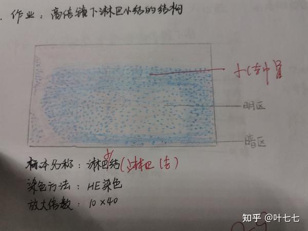 组胚红蓝铅笔图