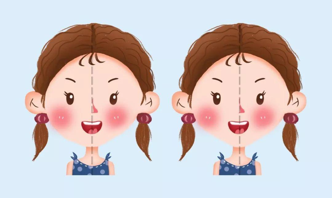 小耳畸形伴随面部畸形大小脸怎么办