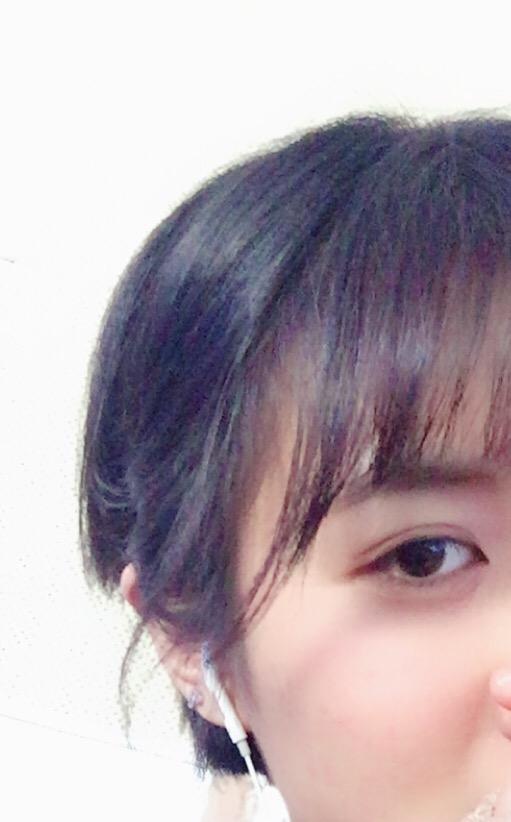 蓄发之路真是道阻且长