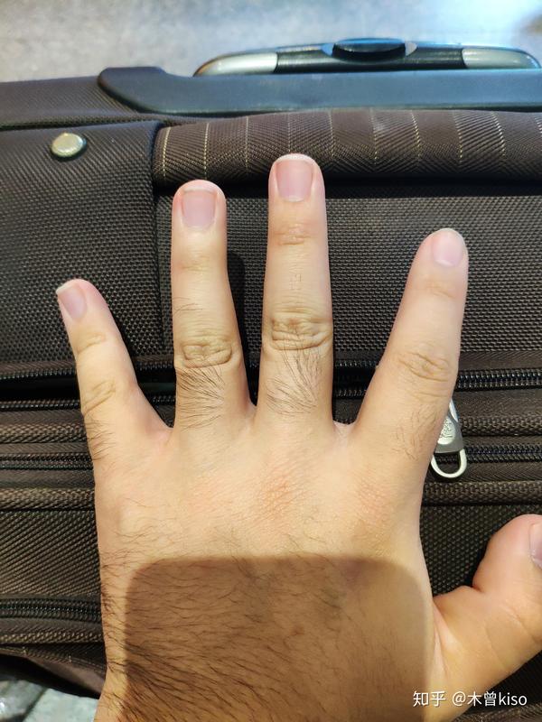 有一双又短又肥的手是什么体验?