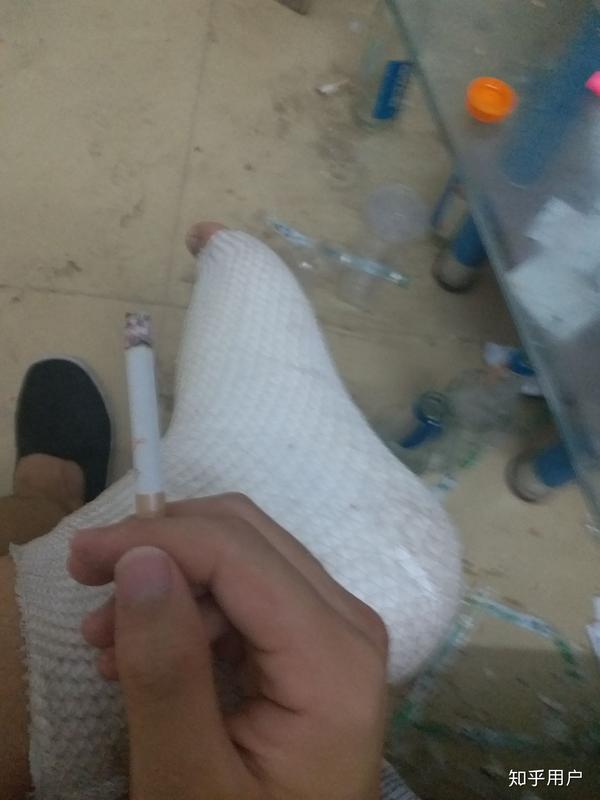 手里的烟,地上的酒瓶, 房间里脏乱,还有脚上的伤 (心里是一万头cnm