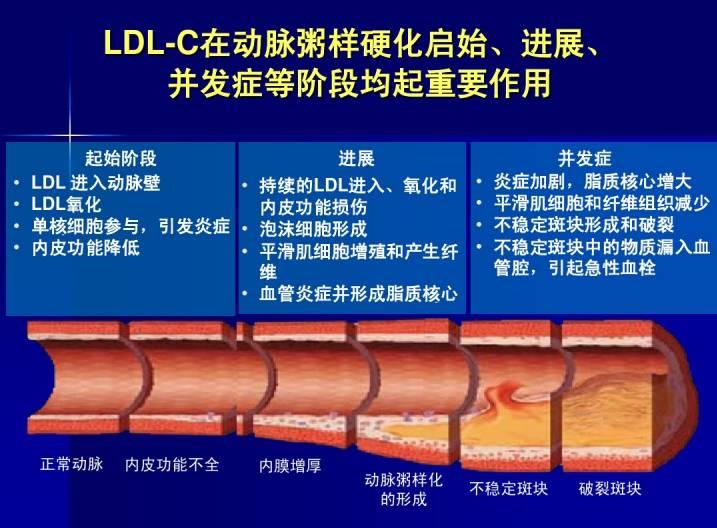 动脉粥样硬化形成过程,这项指标可作为独立危险因素