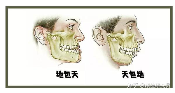 她老公秦昊的问题比较简单,就是牙齿排列不齐,矫正一下会 美观很多.