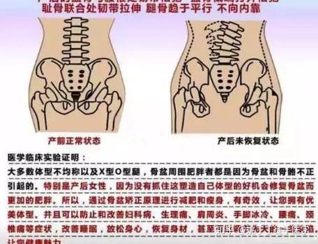 选择骨盆修复原则:不要盲目否则就是在做无用功