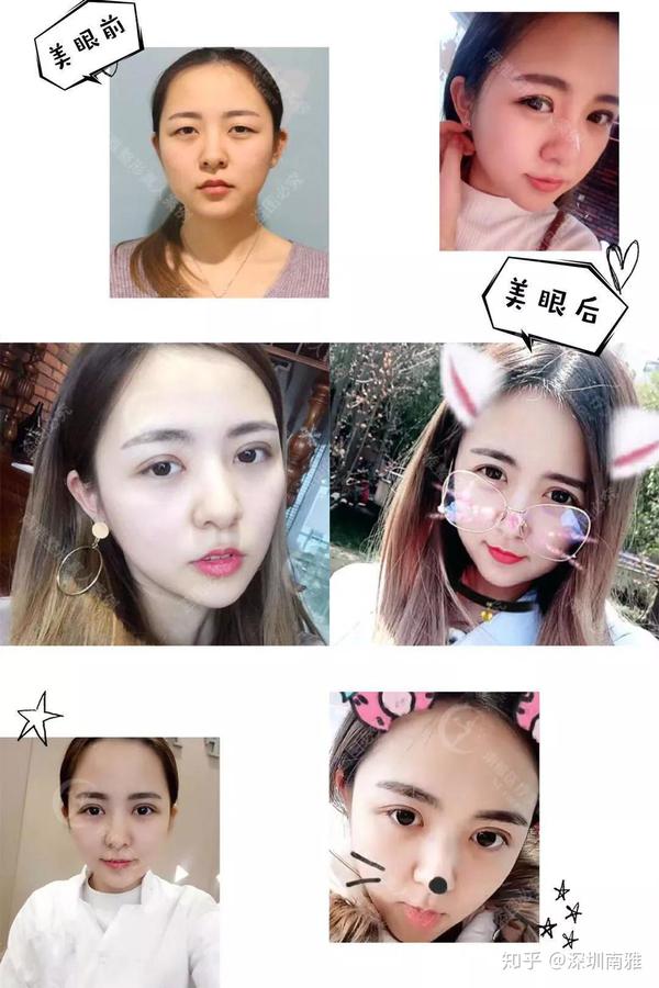 刘ss演戏被嘲像盲人,全因眼睛的这个bug