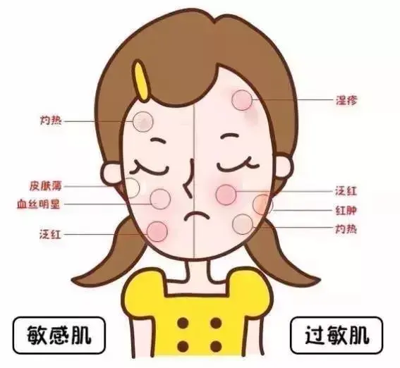 春夏换季,你的脸"遭殃"了吗?