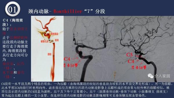 【深度学习】高清头颈动脉系统解剖