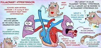 肺动脉高压(病因)分类