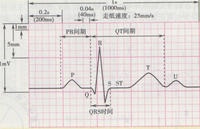 轻松掌握14种心电图
