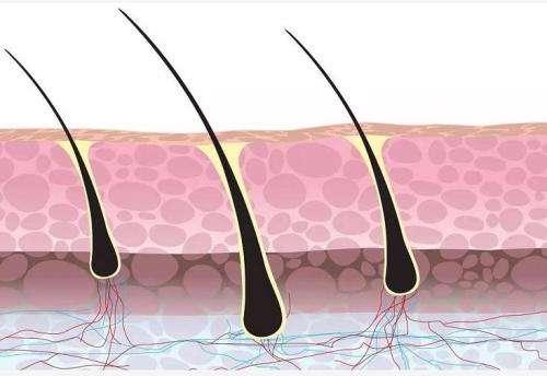毛囊坏死了,头发还能再长出来吗?