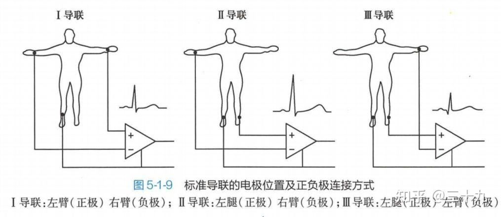 将测量电极置于体表的一定部位记录出来的心脏兴奋过程中所发生的有