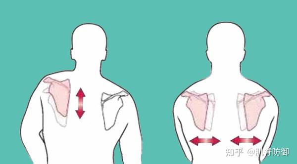肩胛骨不稳会引发颈椎问题