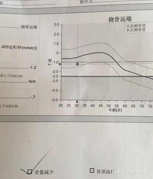 断断续续吃了1年,来看看效果吧 骨密度测试中的t值-1 t值 1表示骨