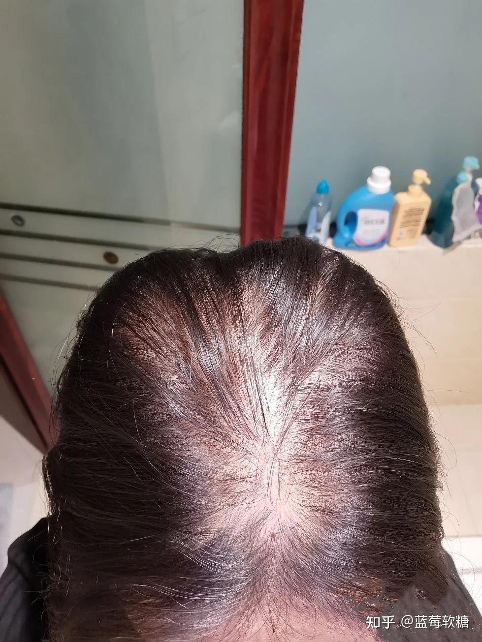 女生头发少是一种怎样的体验