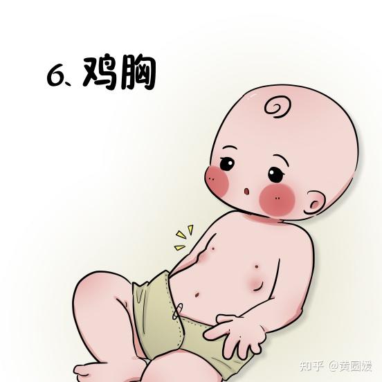 中医治疗以健脾消食,养阴清热为主.功能医学认为食物慢敏,肠