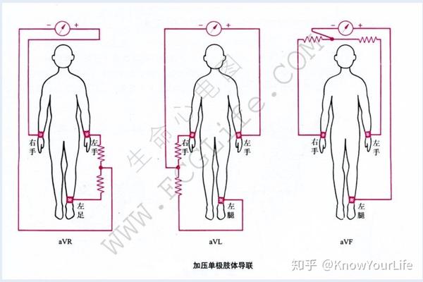 2,胸导联