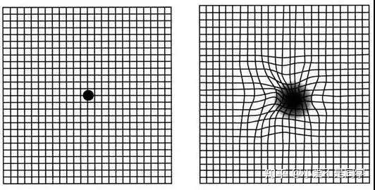 amsler方格表:正常视觉&amp;黄斑病变引起的异常视觉