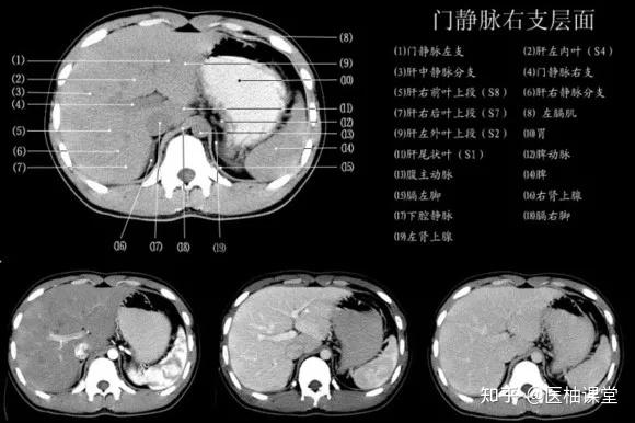 门静脉右支层面