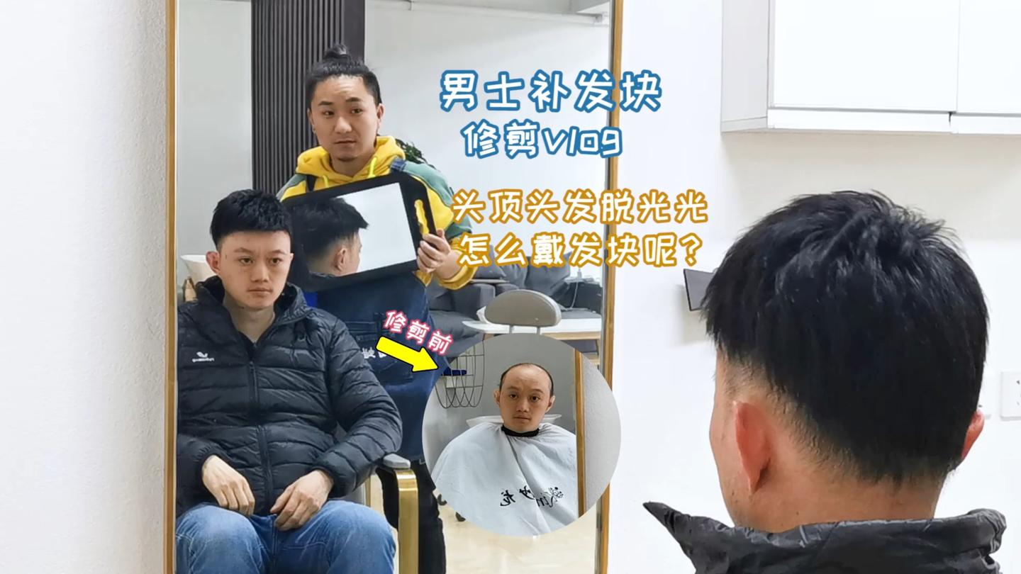 男士补发块修剪vlog,头顶头发脱光光要怎么戴补发块呢