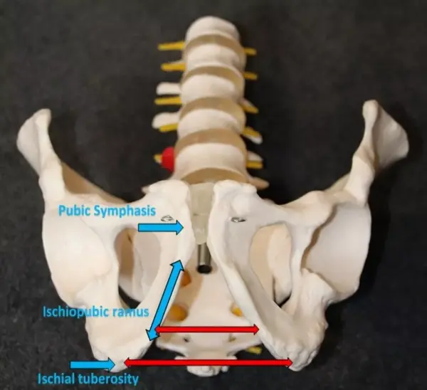 从坐骨结节到坐骨支再到耻骨支,是一个逐渐变窄的倒v字形