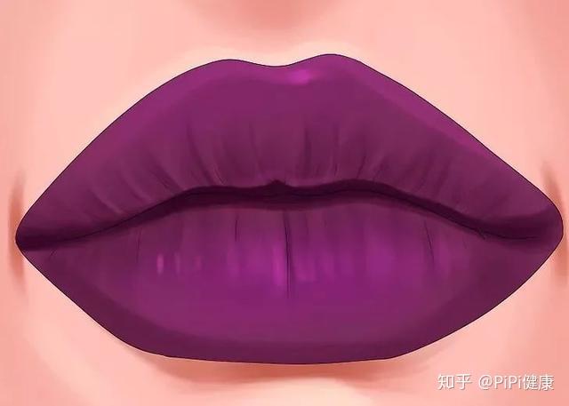 嘴唇发紫——心脏疾病