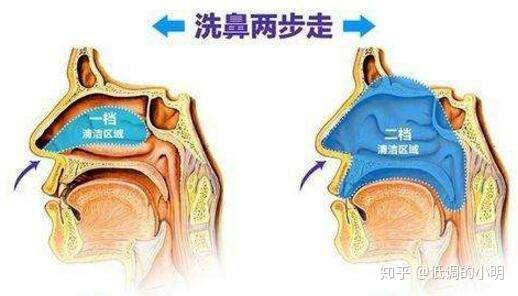 人们为什么没有洗鼻的习惯?