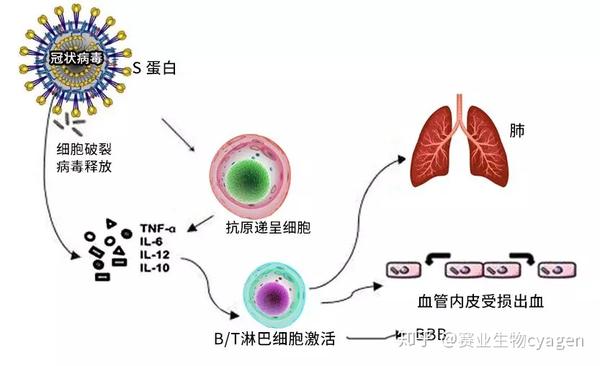 新冠靶点新视角之一细胞因子风暴