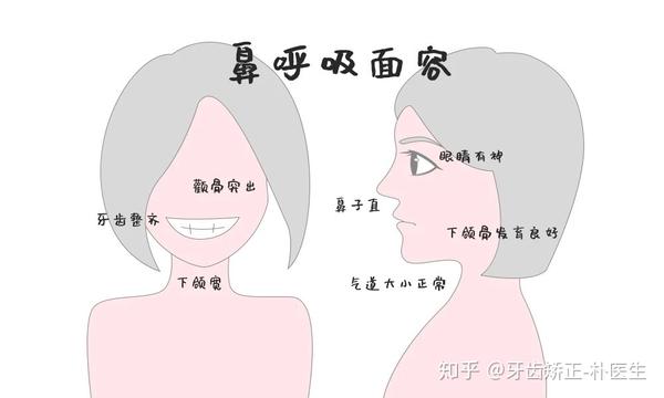 别让口呼吸拖垮孩子的面容