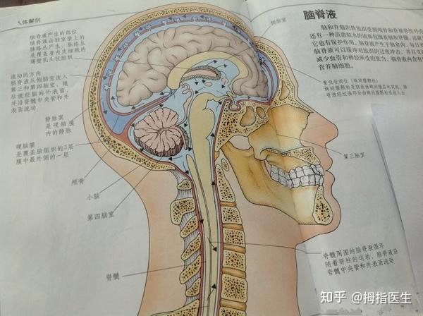 10岁急淋b患儿化疗后做腰穿出现脑脊液是脑白吗?