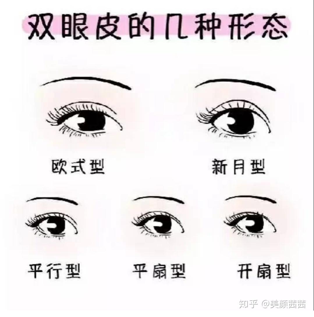 常见的双眼皮形状有5种(平行,新月,开扇,欧式,平扇)1.
