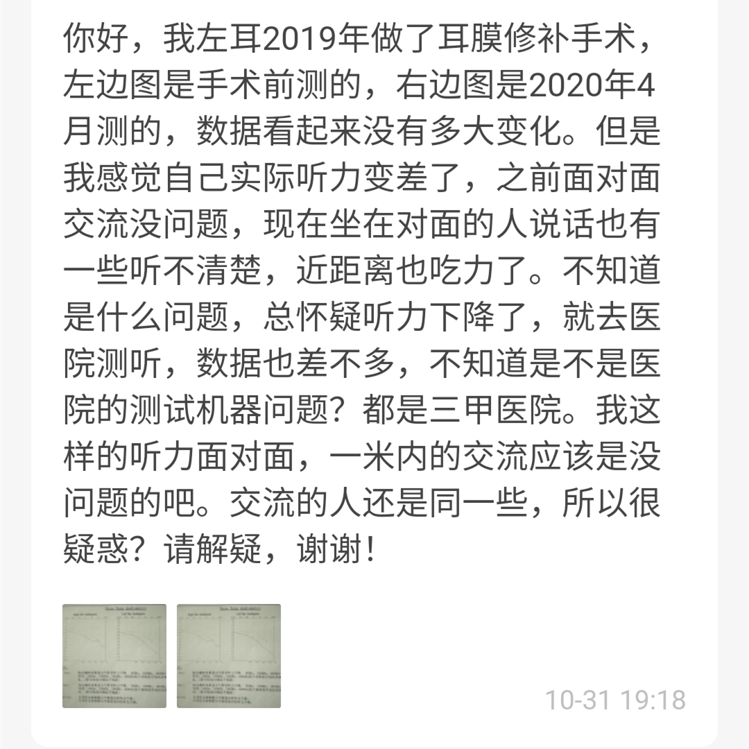 鼓膜破了就会聋修复后听力能恢复正常吗这2种情况可以自愈