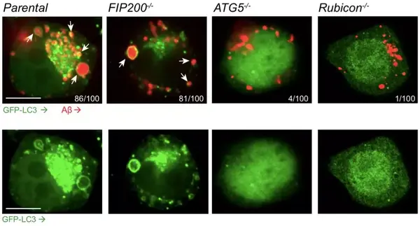 cell丨自噬如何减少脑中异常β淀粉样蛋白沉积